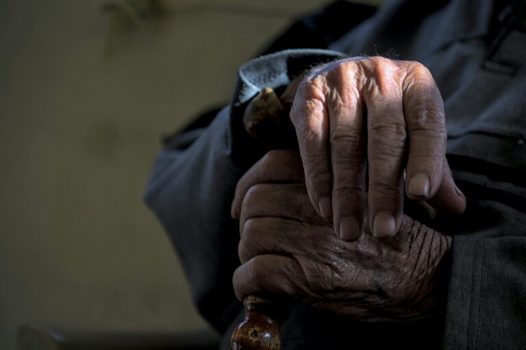 Close-up of elderly hands resting gently on a lap, showing wrinkles, veins, and age spots — symbolizing wisdom, life experience, and the natural aging process.